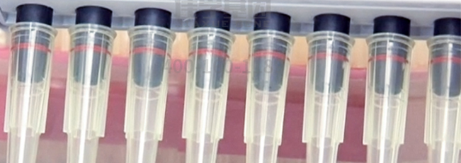 <b>【佳学基因检测】ABCA1基因检测有突变会得什么病？</b>