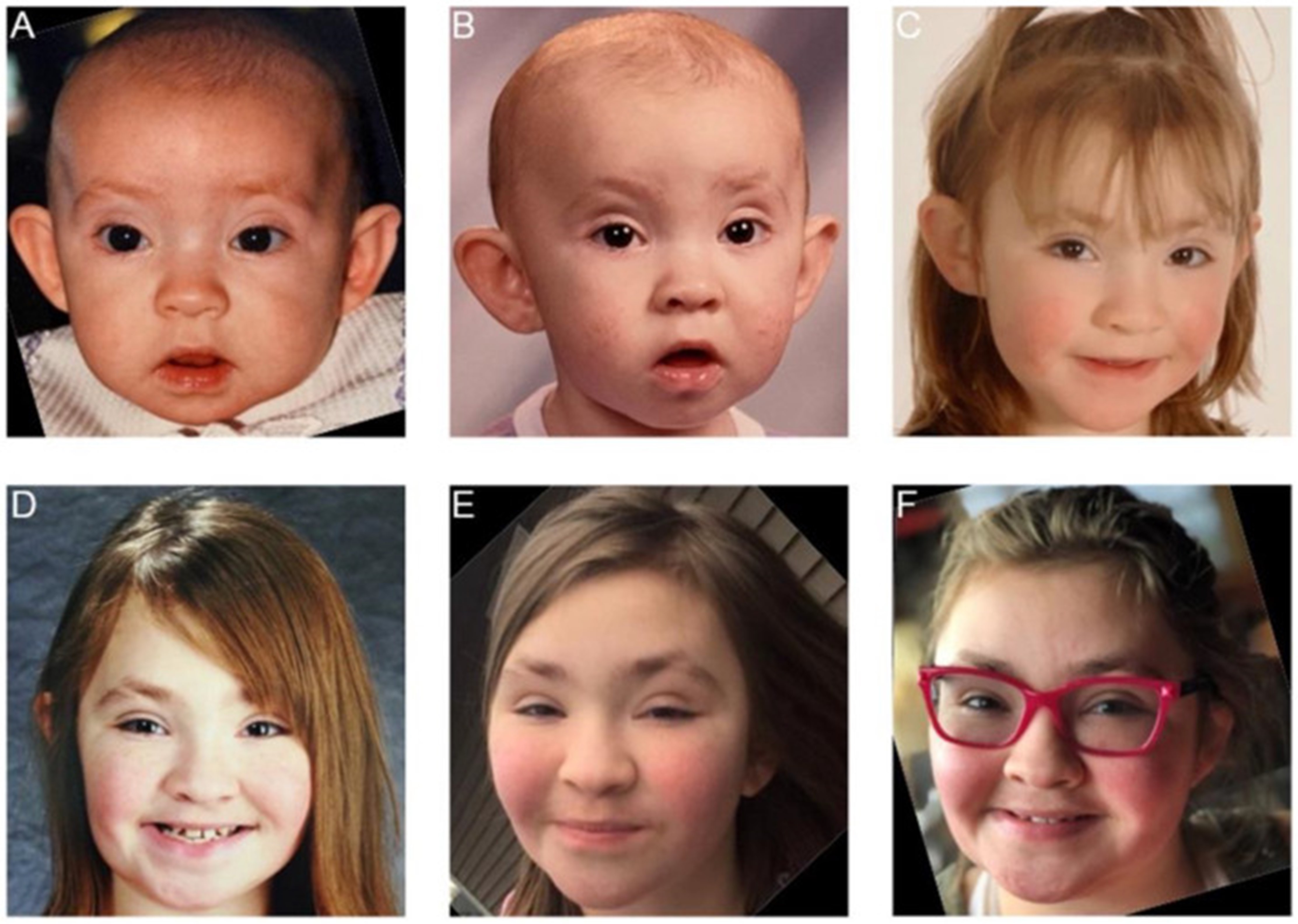 <b>【佳学基因检测】疾病风险评估包中为什么一定要有CR1L基因？</b>