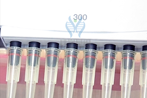 <b>【佳学基因检测】遗传代谢科基因评估分析知识测验中关于FPR2的准备</b>