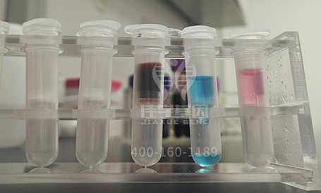 <b>【佳学基因检测】突变检测ETV5存在移码突变，值担心吗？</b>